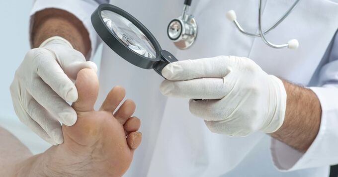 Kiểm tra chẩn đoán móng chân