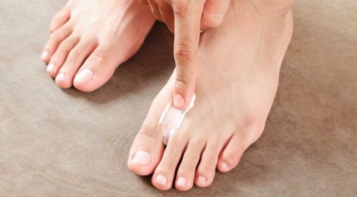 cách và cách điều trị nấm giữa các ngón chân