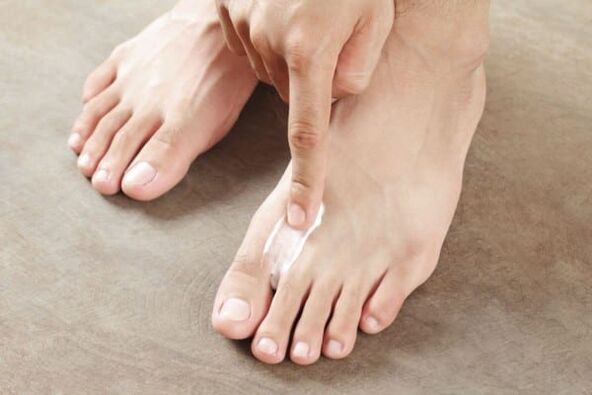 áp dụng thuốc mỡ từ nấm da trên chân