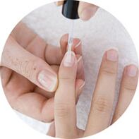 sơn móng tay để điều trị nấm móng tay